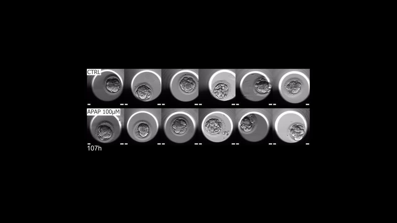 Paracetamol (N-acetyl-para-aminophenol) disrupts early embryogenesis by cell cycle inhibition | Human Reproduction