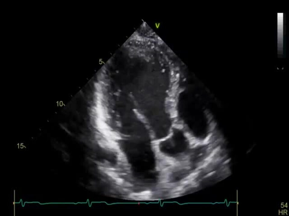 PDF) Novelties in 3D Transthoracic Echocardiography