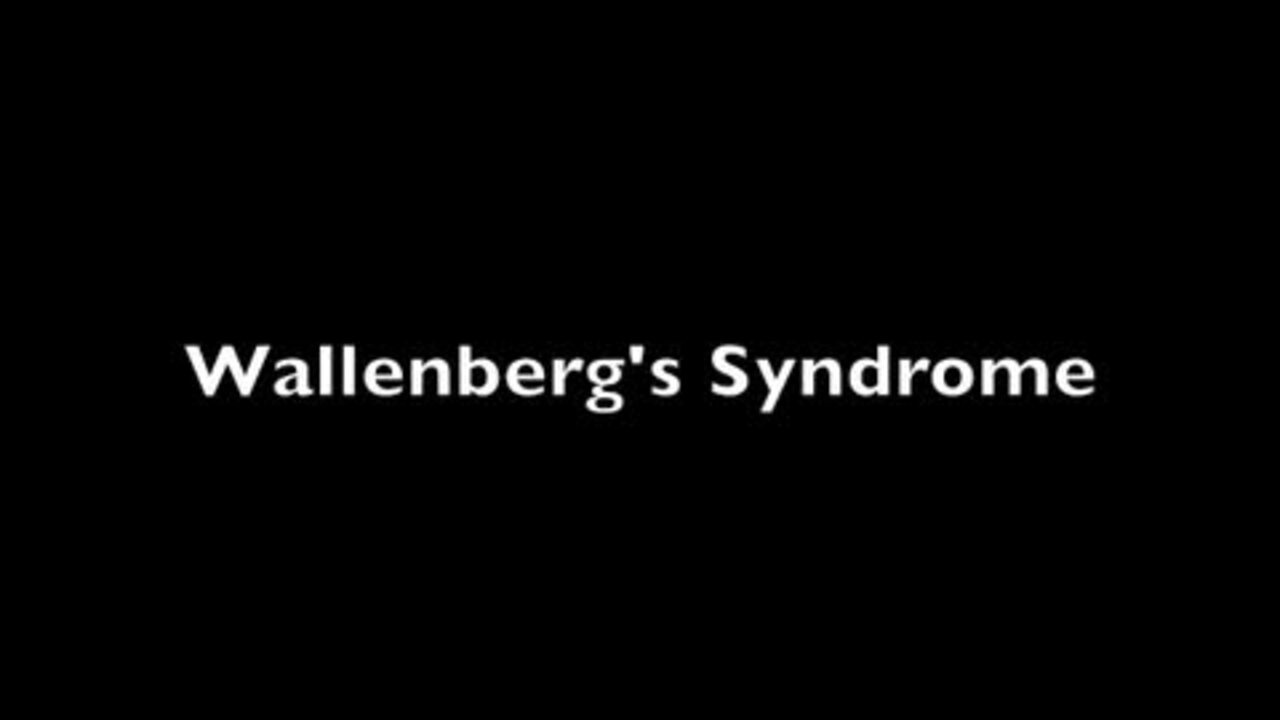 dizziness-vertigo-and-syndromes-of-the-medulla-eye-43-off
