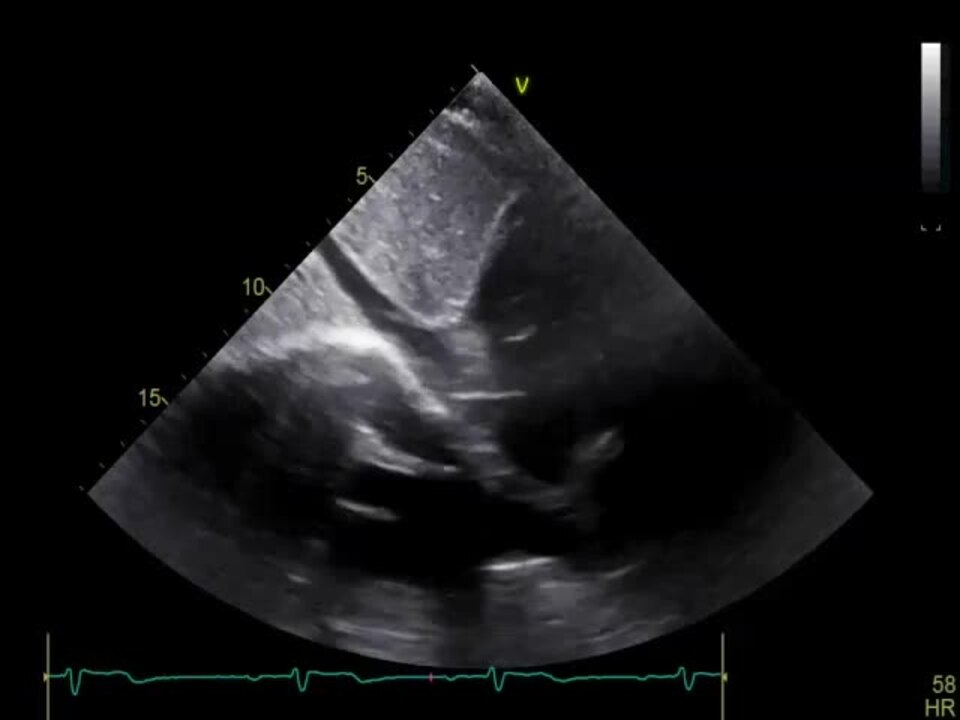 PDF) Novelties in 3D Transthoracic Echocardiography