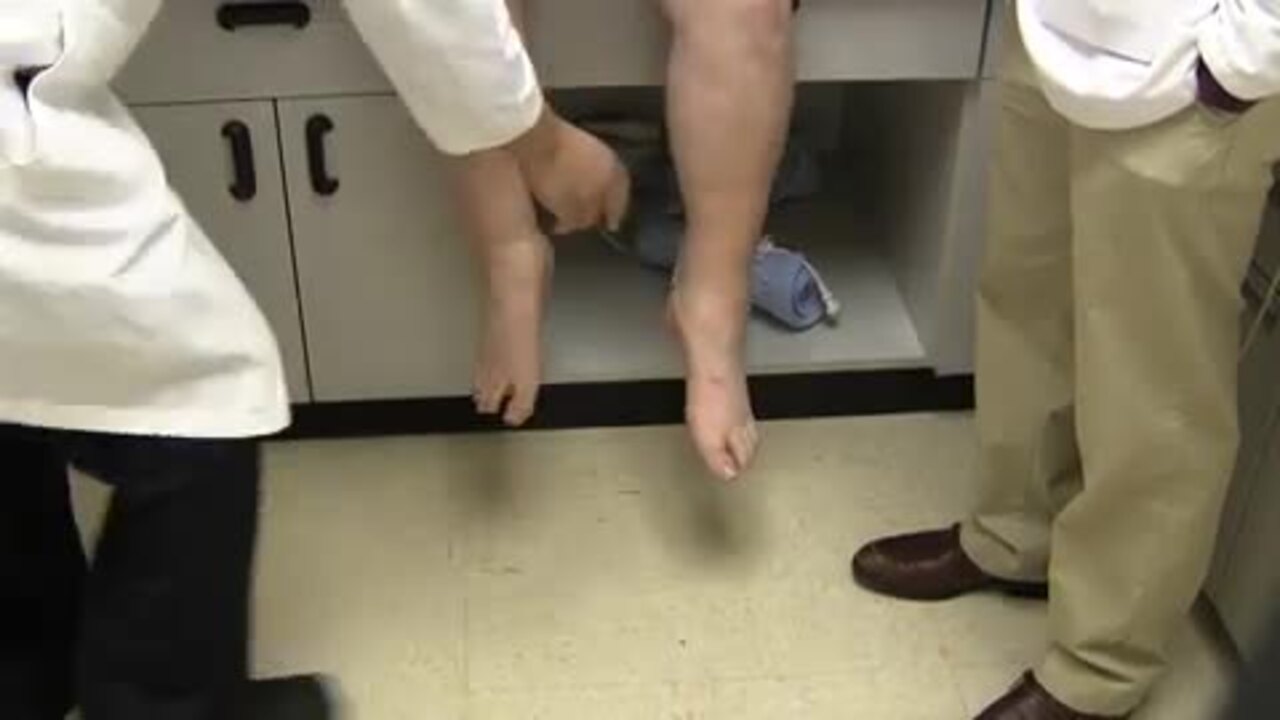 Quadriceps Weakness | A Video Atlas of Neuromuscular Disorders