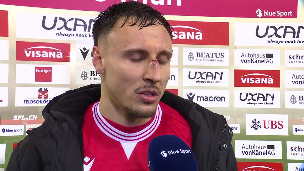 Franke: «Ich denke, die Nase ist gebrochen»