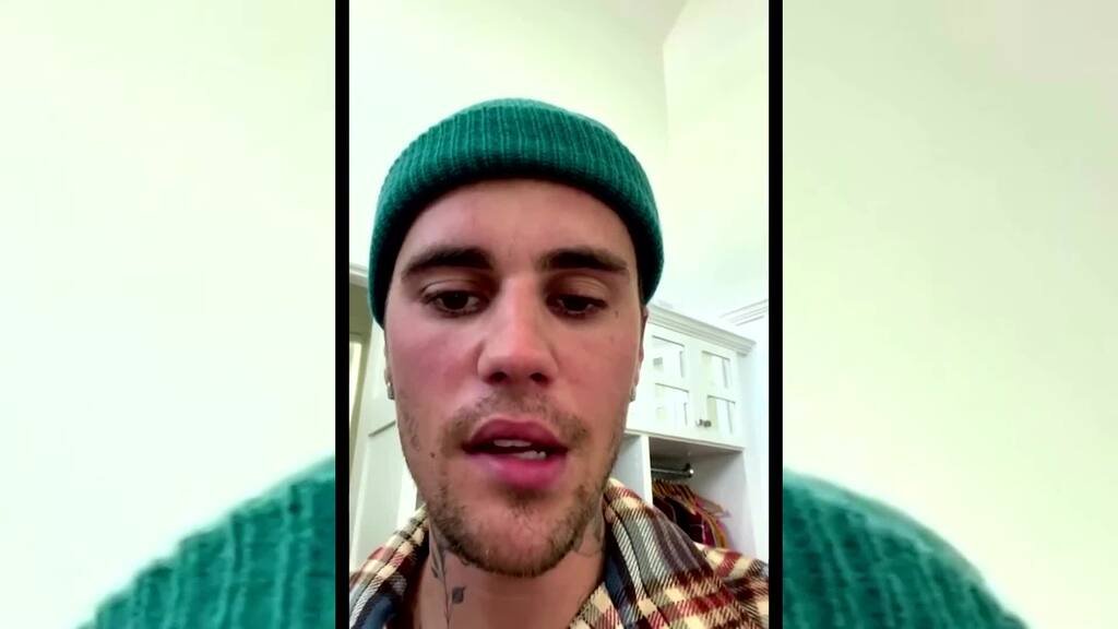 Justin Biebers Gesicht halbseitig gelähmt