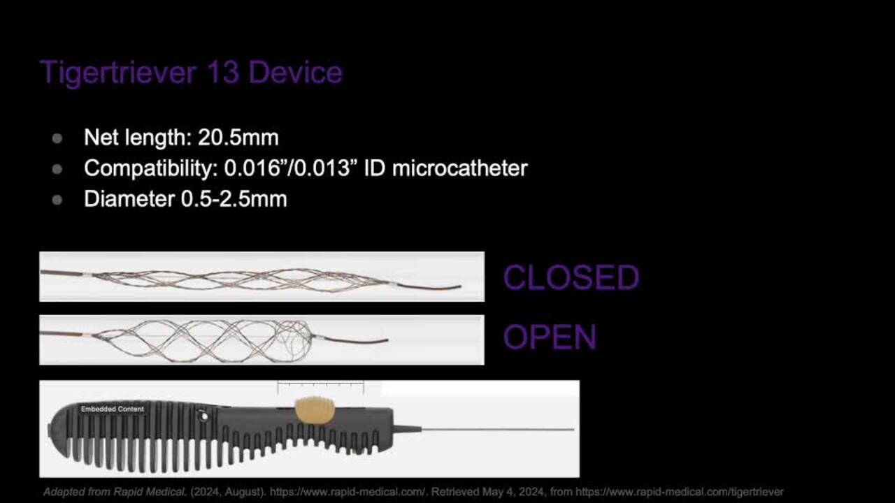 Removal of errant coils using the Tigertriever-13 | Journal