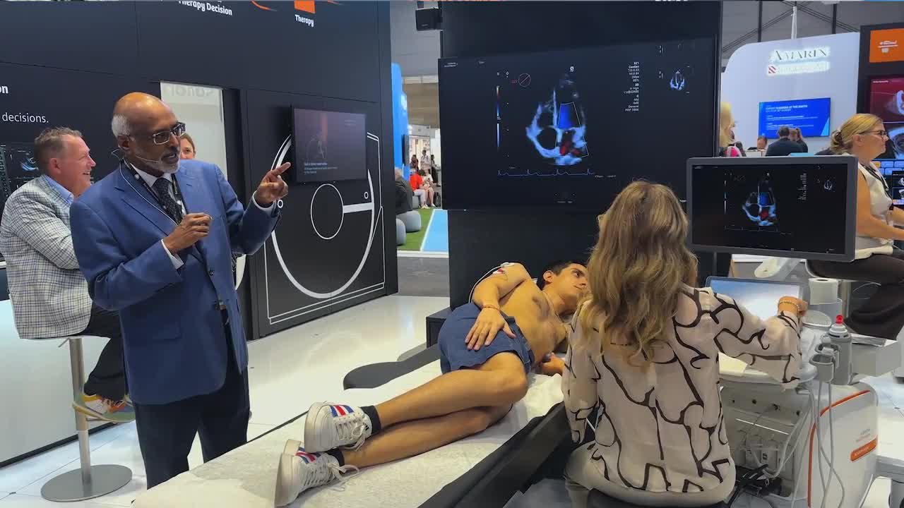 Ultrasound Machines - Siemens Healthineers Singapore