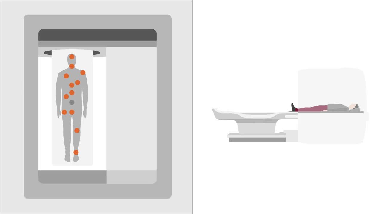 MAGNETOM Free.Max - デジタルと新しい磁場強度0.55テスラの融合