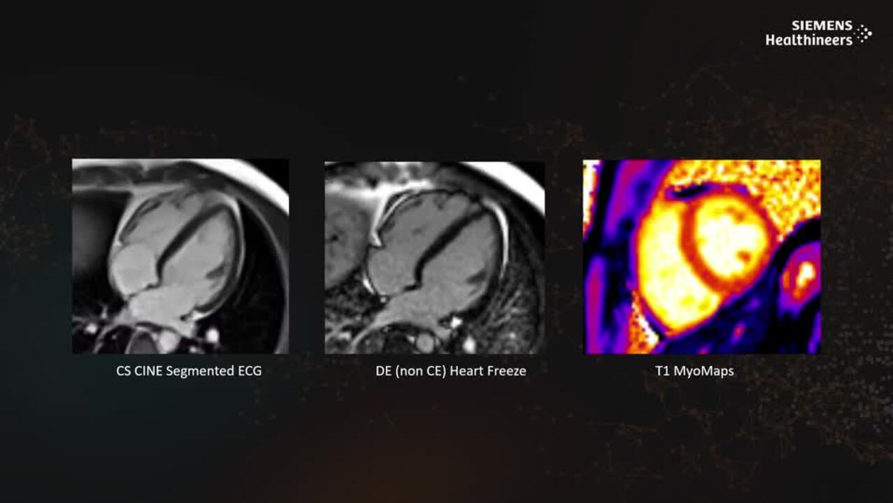 MAGNETOM Free.XL – Leading the way - Siemens Healthineers España