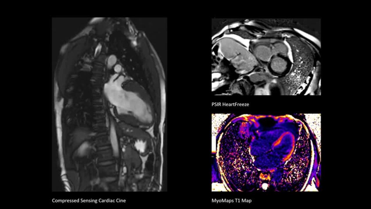 BioMatrix テクノロジー搭載 MAGNETOM Sola 1.5T MRI - Siemens