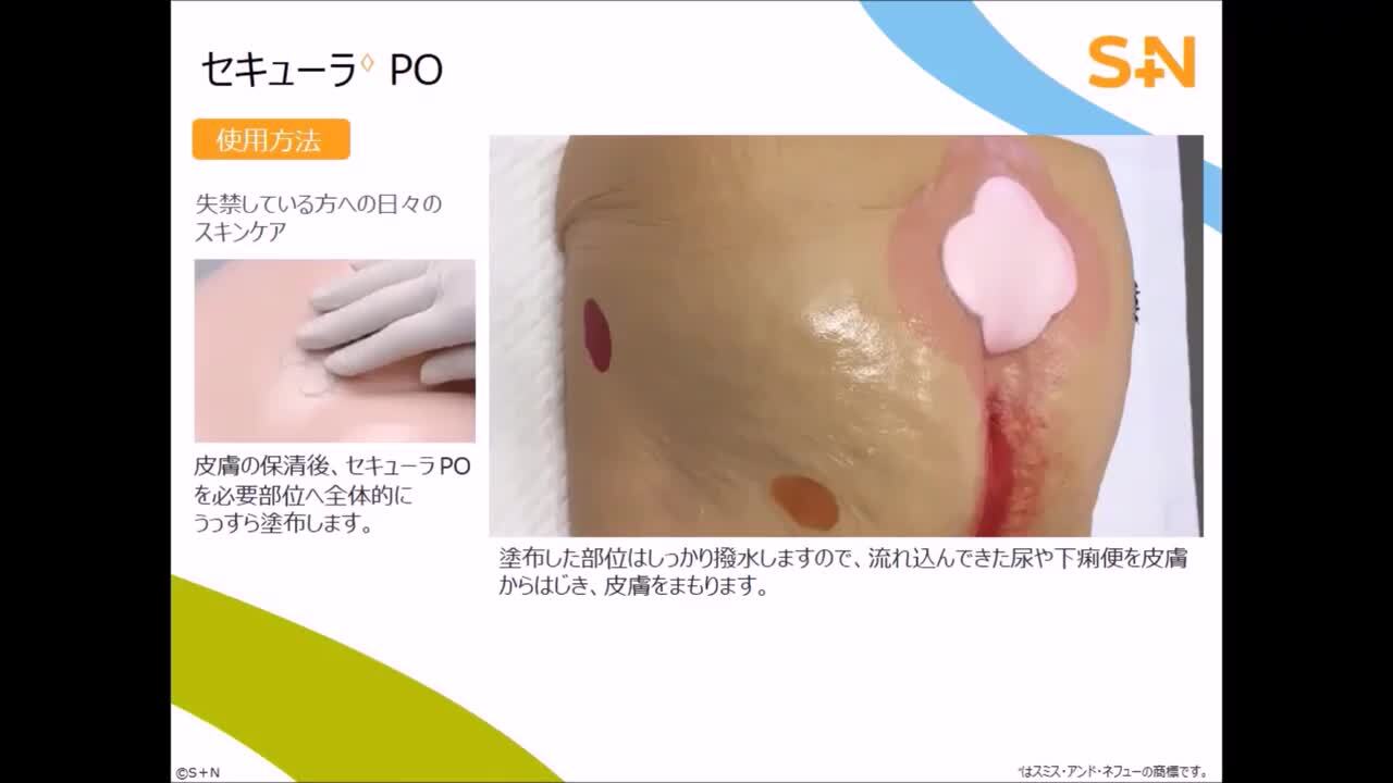 セキューラPO 159g 5本セット www.poltekkes-bsi.ac.id