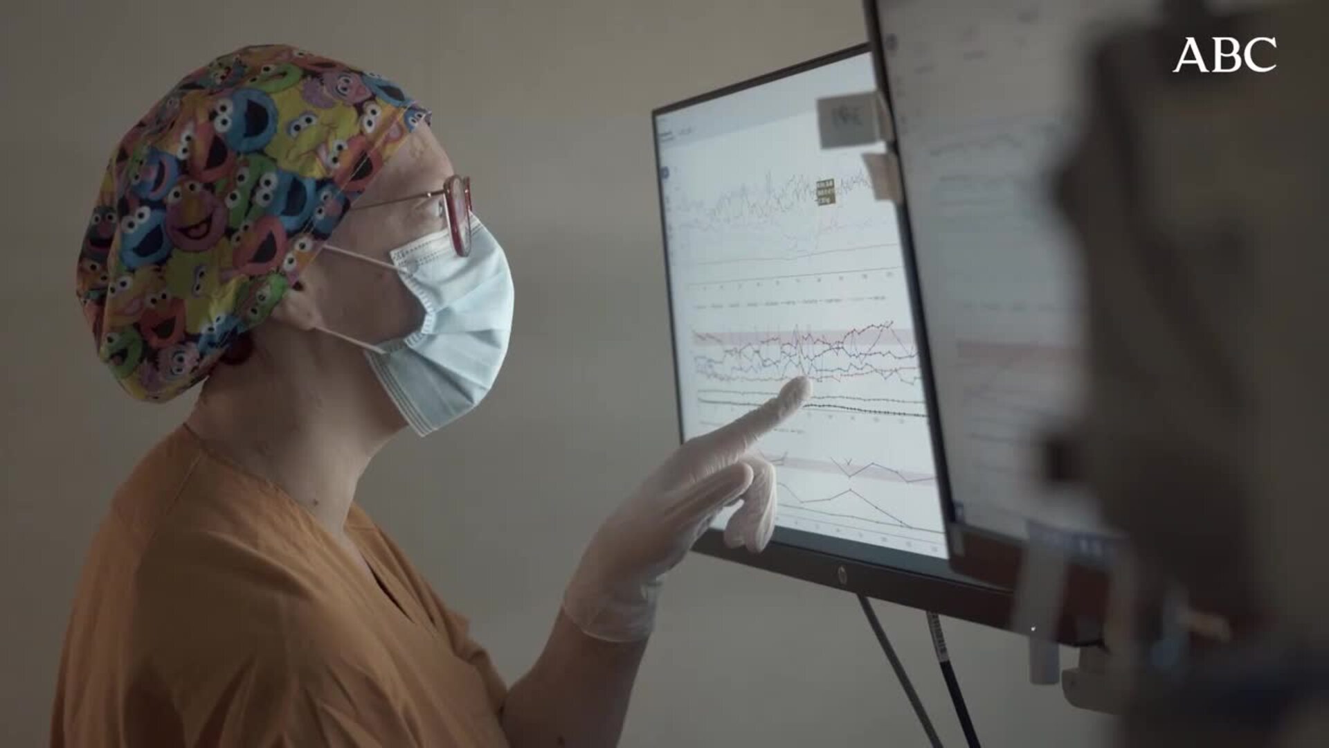 Primer prototipo de placenta artificial desarrollado por BCN Fetal