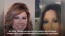 El cambio físico de la cantante Tamara que ha sorprendido a sus seguidores