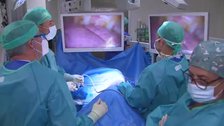 Los nódulos pulmonares pueden ser operados con técnicas quirúrgicas mínimamente invasivas