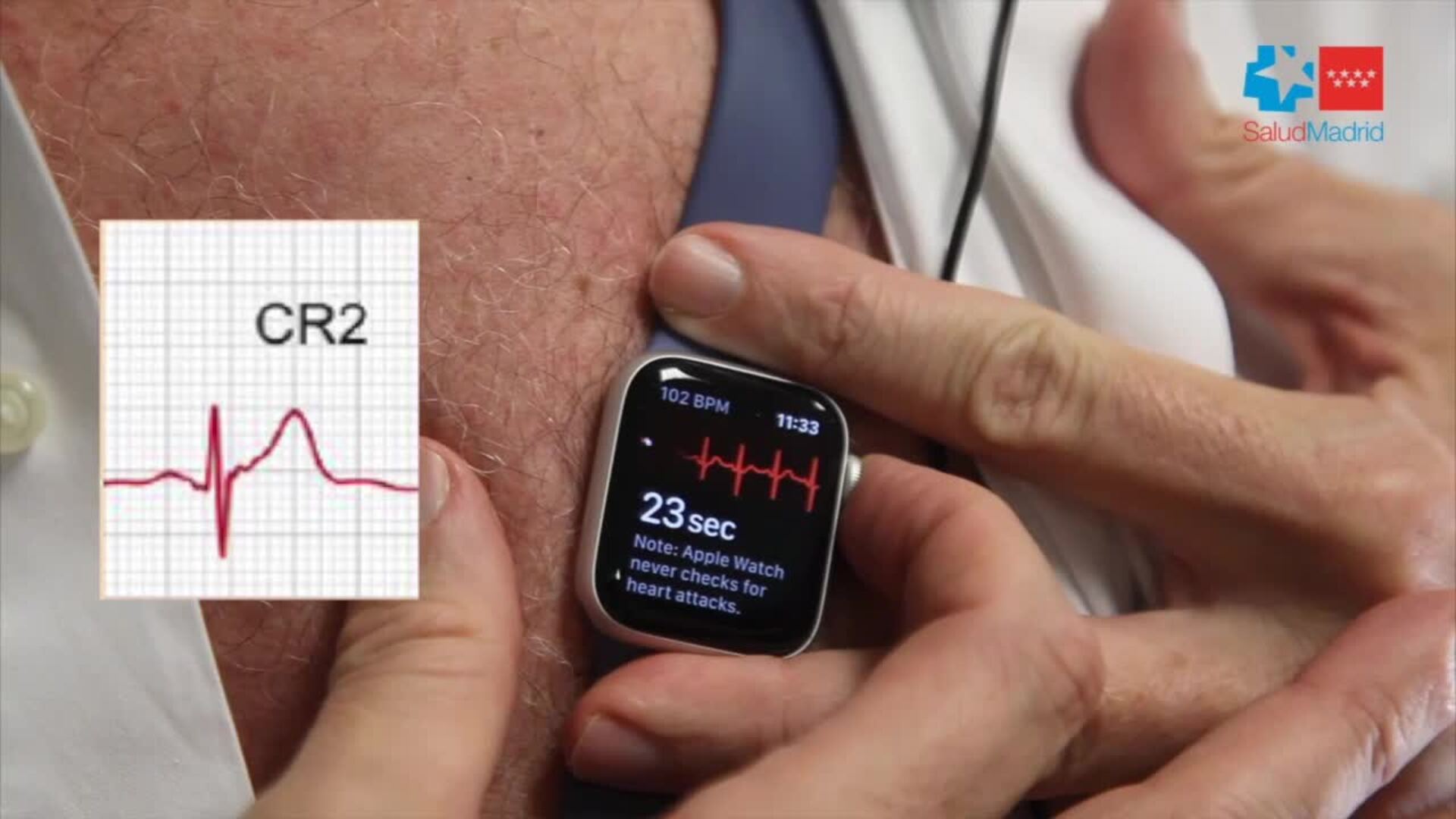 Un médico descubre cómo hacer un electrocardiograma con un «smartwatch»