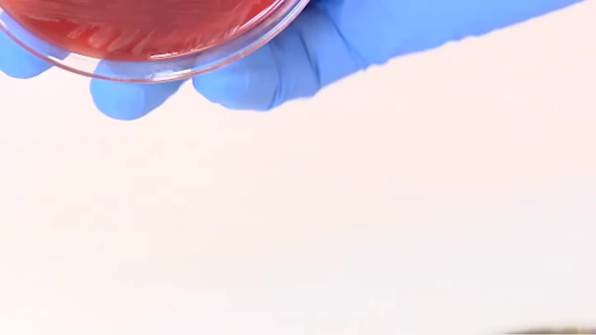 Andalucía decreta la tercera alerta sanitaria por listeria en una nueva marca