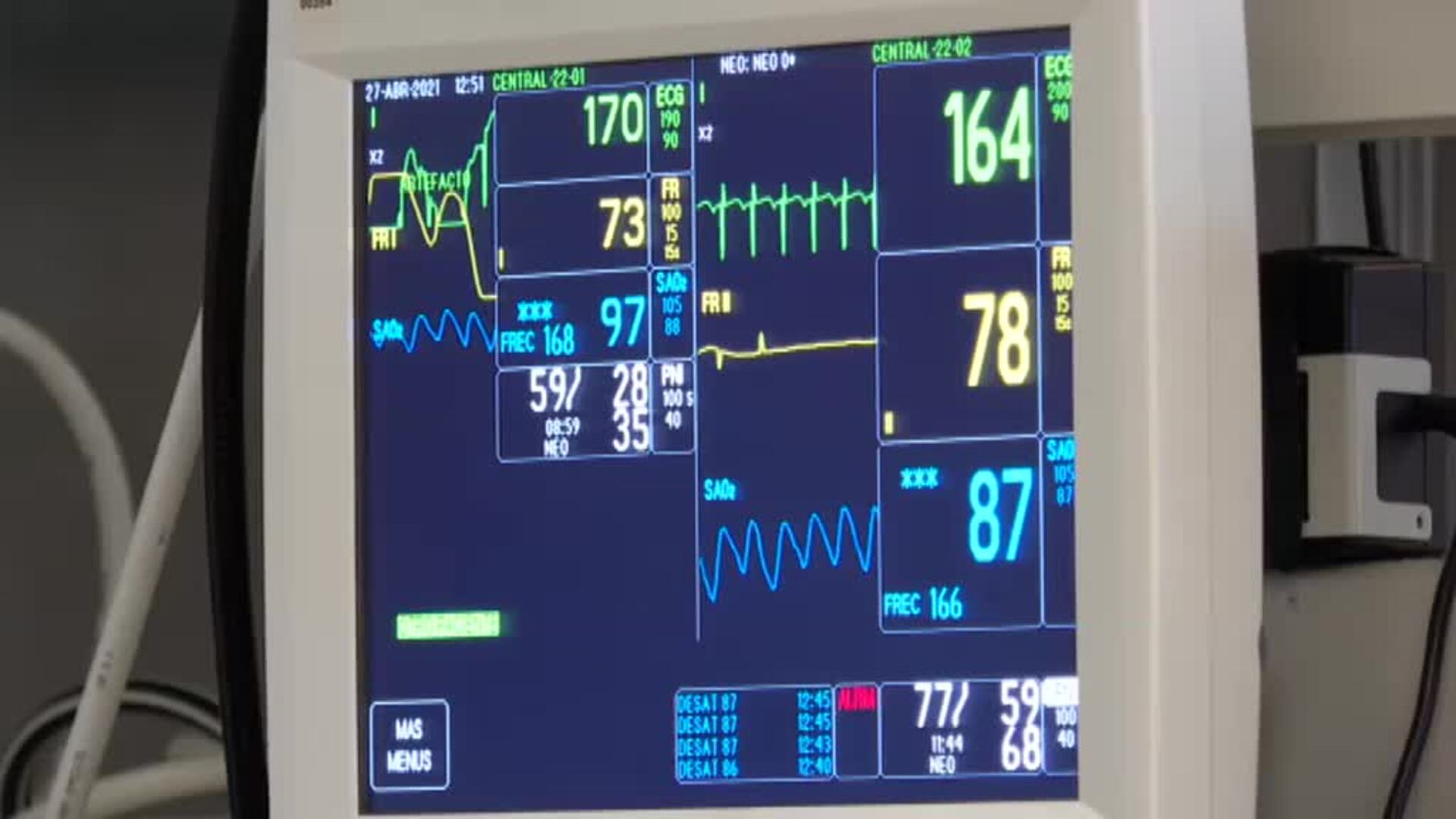 Trillizos prematuros, &quot;piel con piel&quot; con su madre gracias a la oxigenoterapia