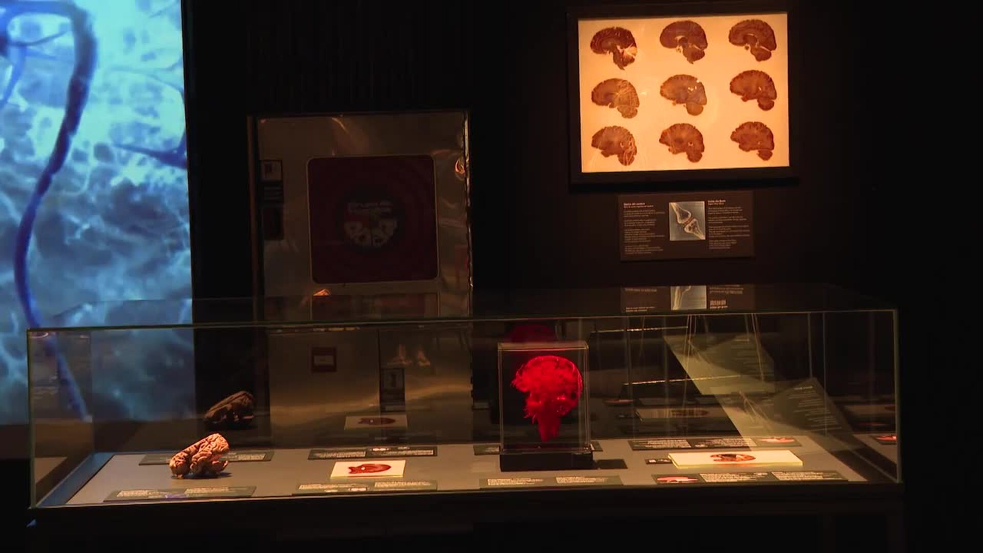 &#039;Body Worlds&#039;, la exposición del cuerpo humano llega a Madrid