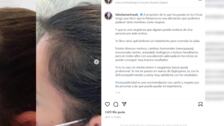 Fabiola Martínez confiesa que ella también sufre de alopecia y ataca a Chris Rock