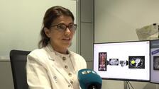 L'Hospital del Vall d'Hebron desenvolupa una IA per analitzar tumors hepàtics