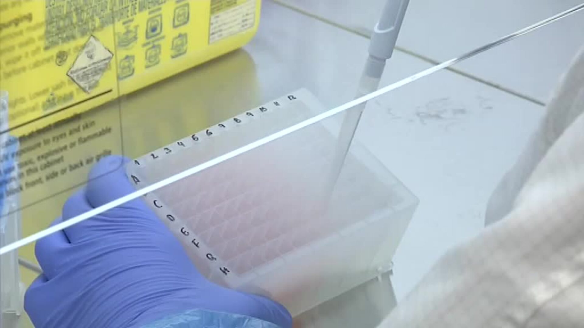 Comienzan a comercializarse los pcr con saliva