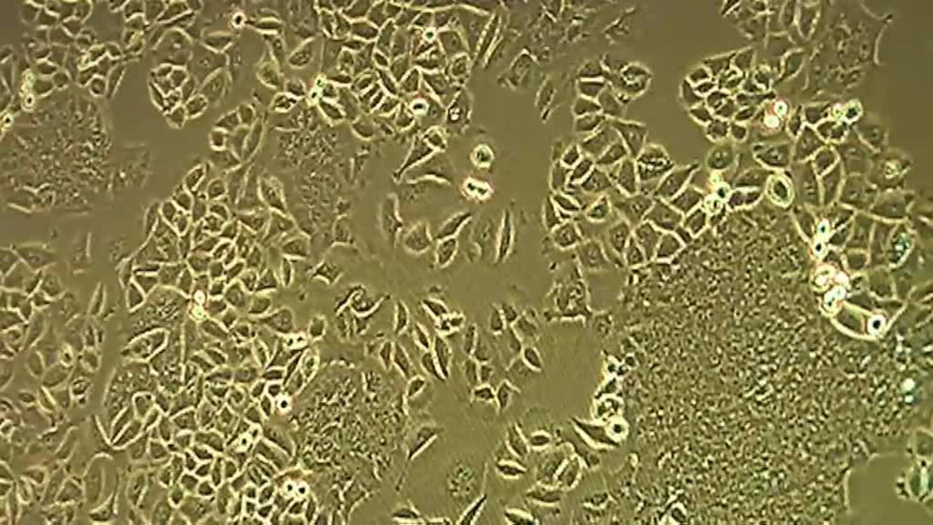 Un equipo de científicos descubre una proteína que retrasa el envejecimiento