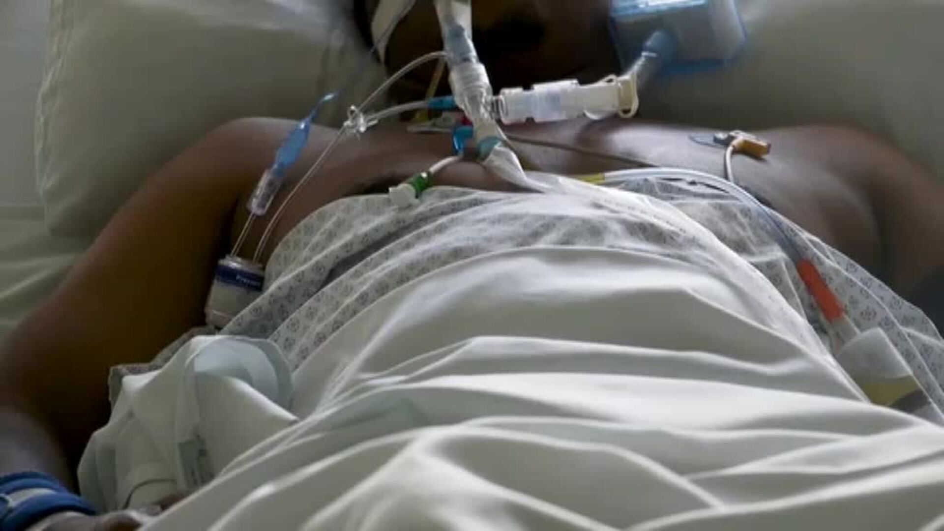 África se acerca a los 100 mil muertos  por coronavirus