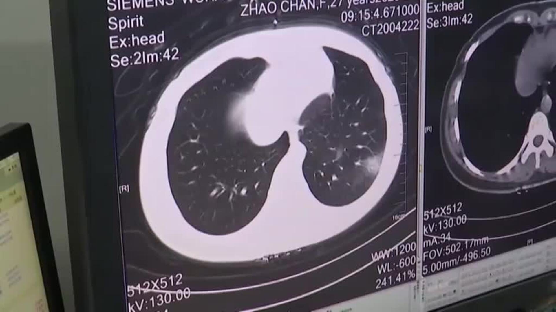 La cifra de muertos por el coronavirus aumenta a 427 y hay más de 20.000 contagiados