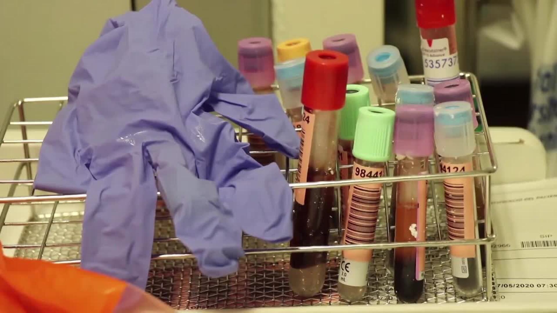 España registra 48 muertes por Covid-19 en un día y 361 contagios confirmados