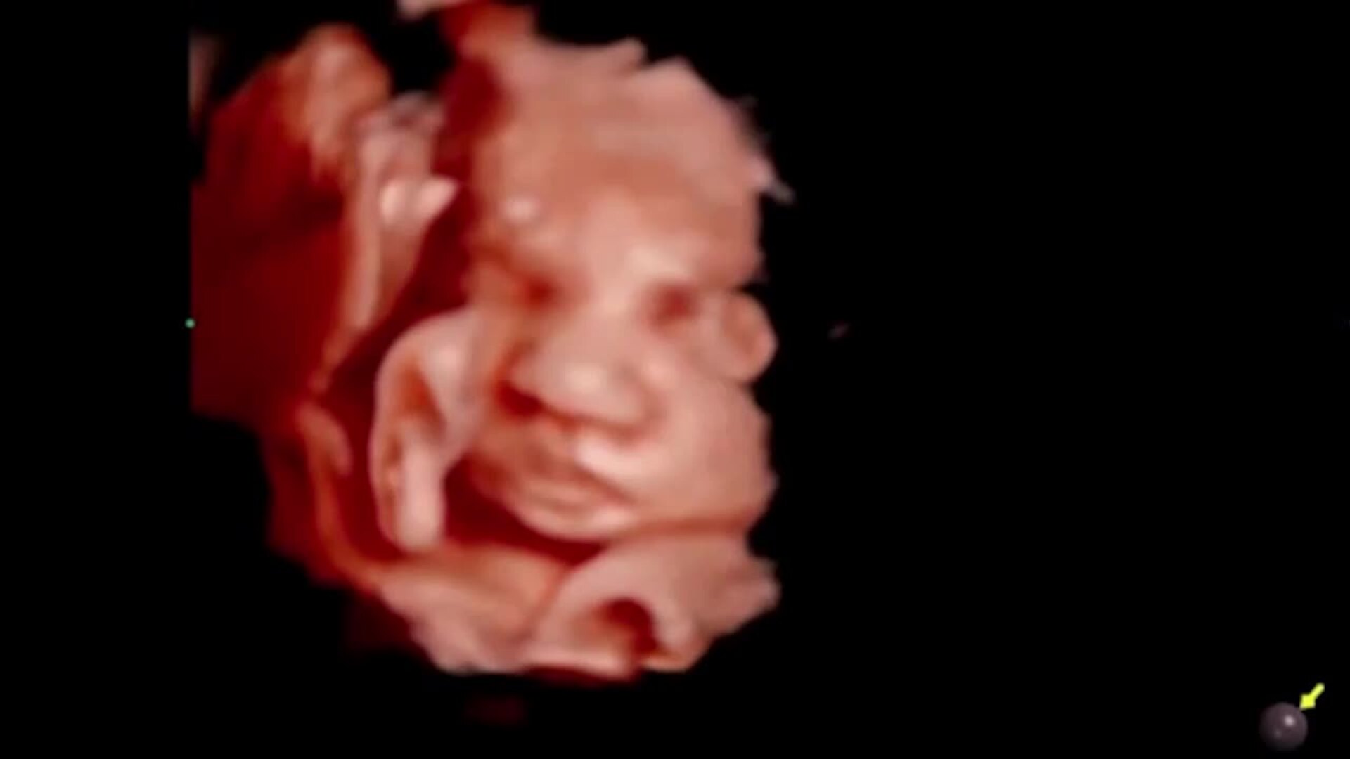 Tomás Páramo y María García de Jaime muestran a su hija en 5D