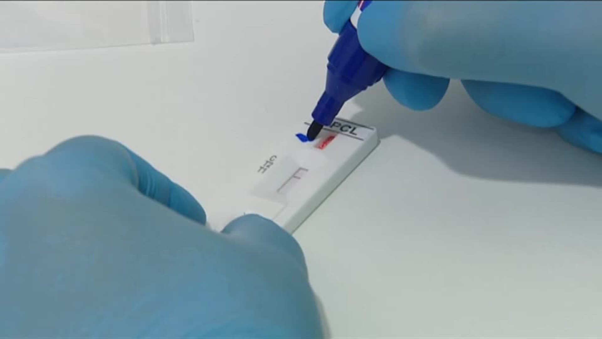 36.0000 hogares participarán en el estudio de seroprevalencia a partir de la semana que viene