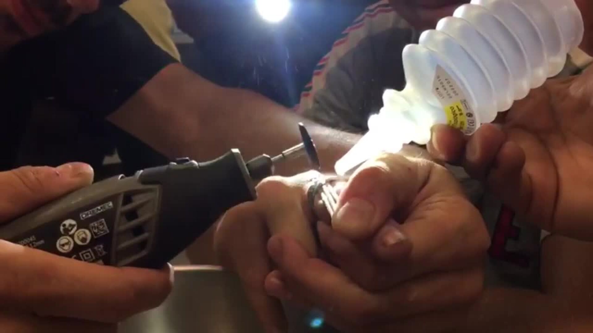 Bomberos cortan un anillo del dedo de un niño