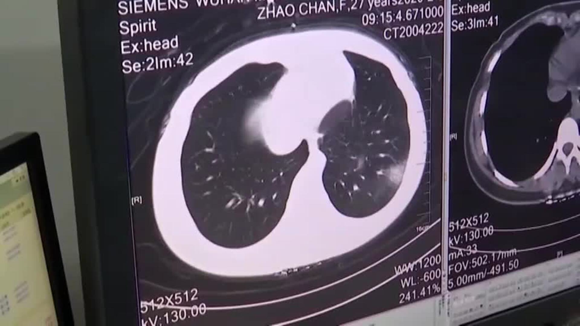 El coronavirus sigue fuera de control y se acerca ya al millar de víctimas mortales