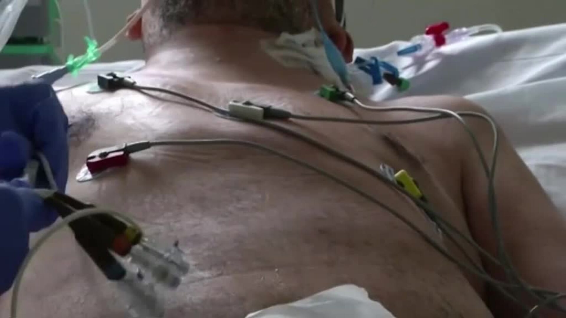 Brasil: 250.000 muertos por coronavirus al cumplir un año del primer caso