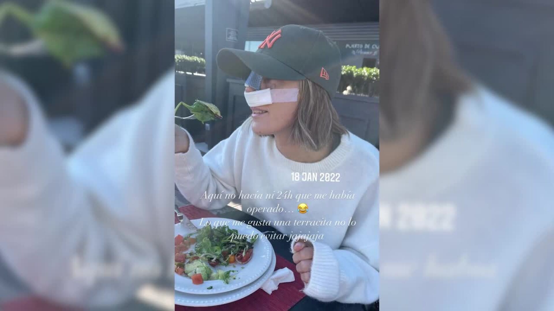 Anna Padilla anuncia que se ha sometido a una rinoplastia