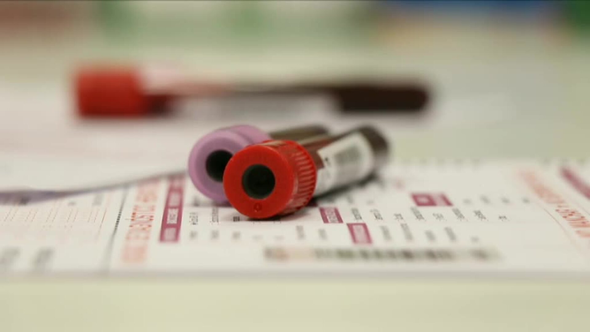 Plasma de hiperinmunes como alternativa contra el coronavirus a la espera de la vacuna