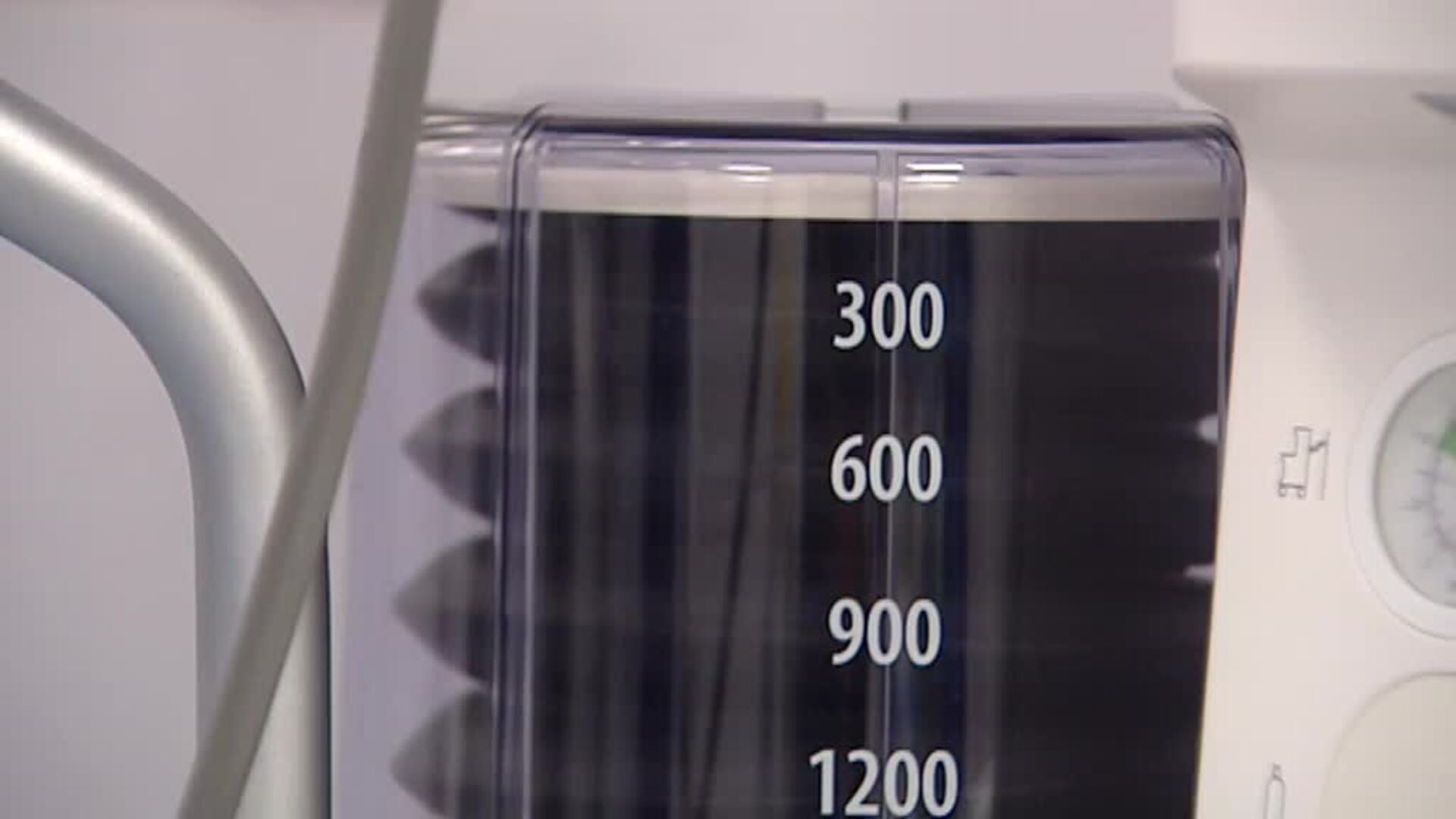 A punto de fabricarse los primeros respiradores artificiales con impresión 3D