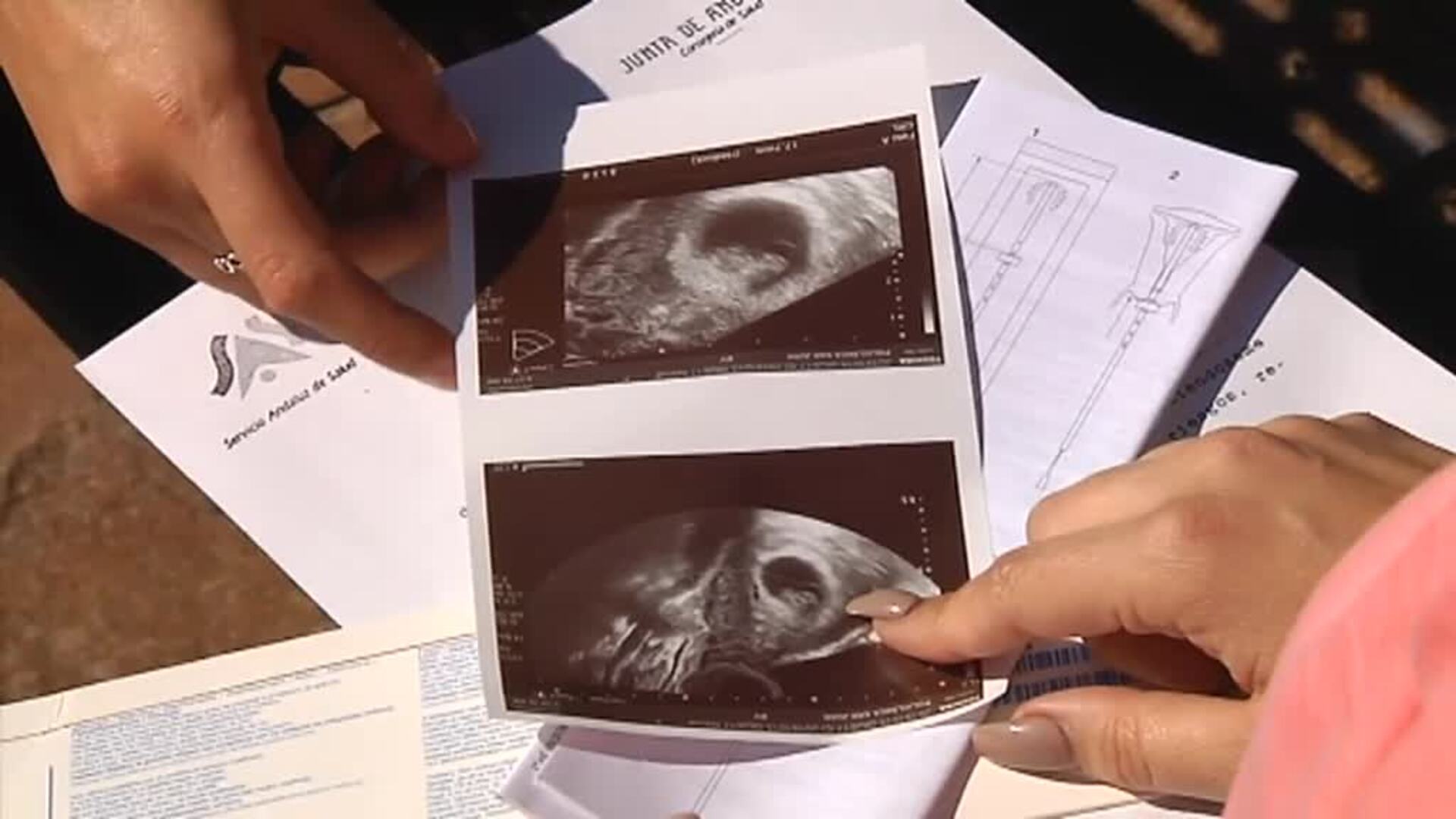 Psicólogos, control del latido del feto y ecografías 4D para evitar abortos  en Castilla y León
