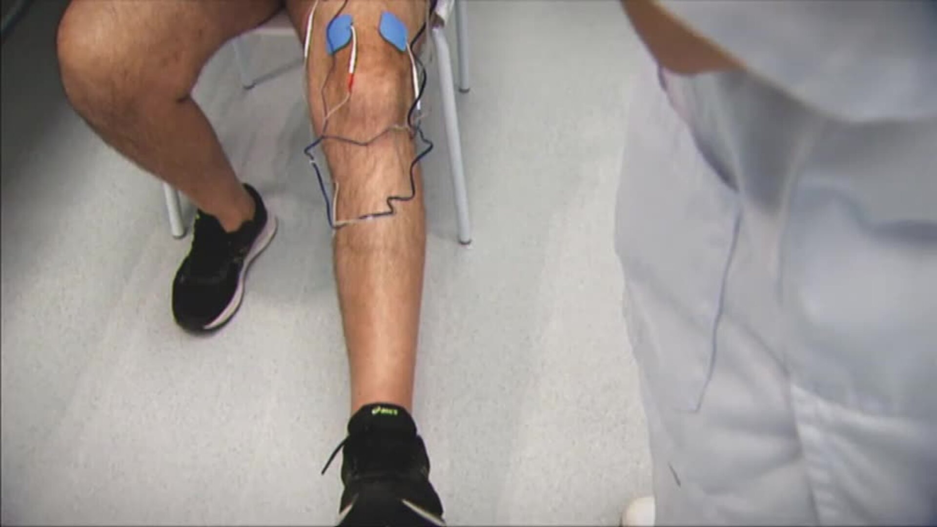 Uno de cada diez enfermos de coronavirus tendrá el síndrome postcovid duradero tras el alta