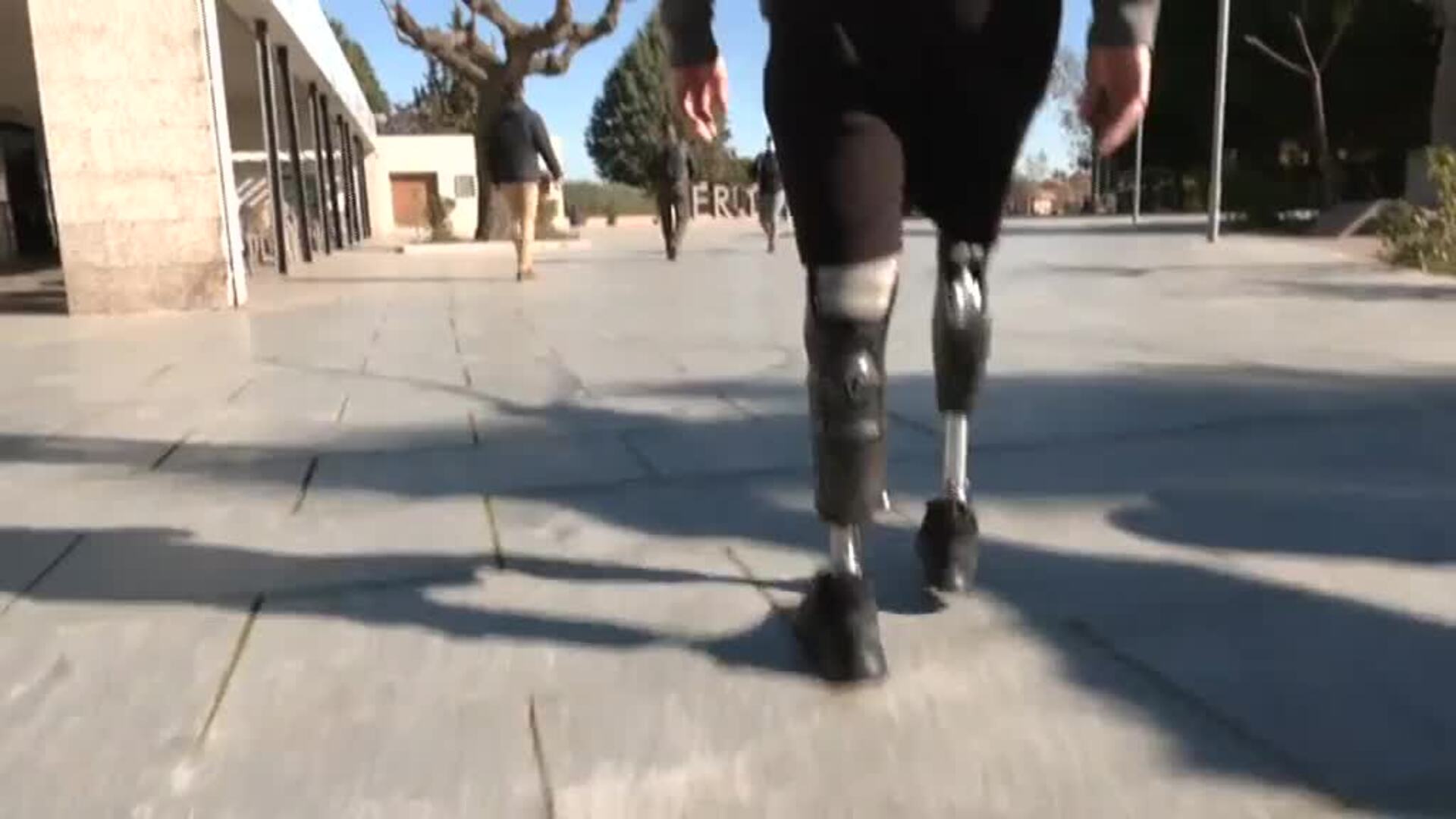 Personas con prótesis denuncian la falta de financiación de prótesis modernas