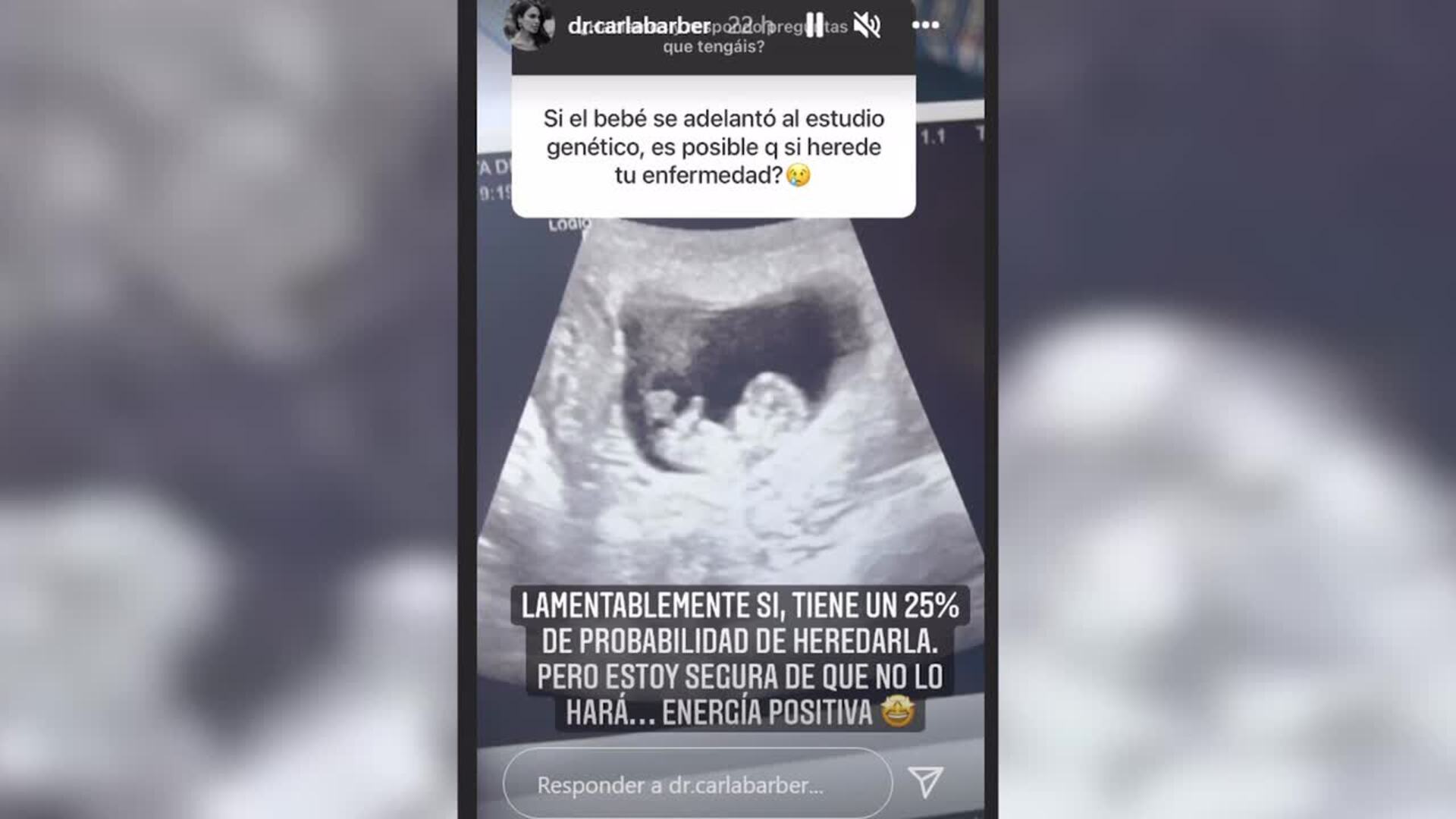 Carla Barber desvela más detalles de su embarazo