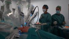 Hito médico: Vall d'Hebron realiza el primer trasplante de pulmón solo robótico del mundo