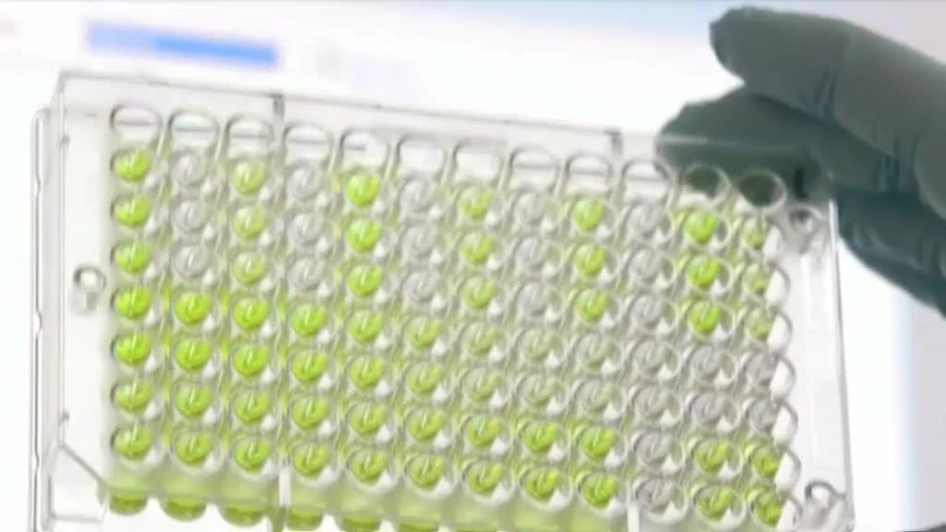 Pfizer anuncia que su vacuna contra el coronavirus obtiene un 90 por ciento de eficacia