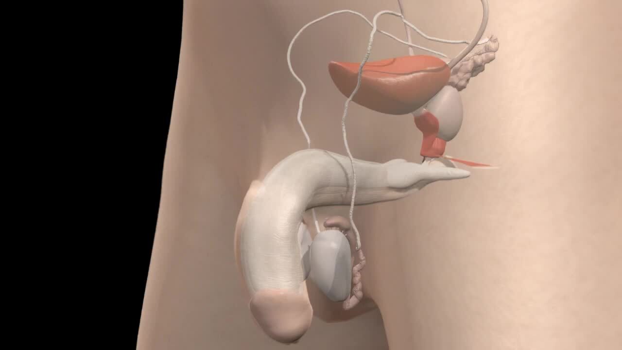 Prostate enlargement animation