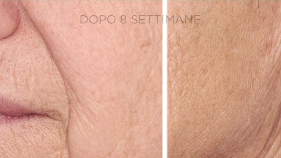 Guarda il video