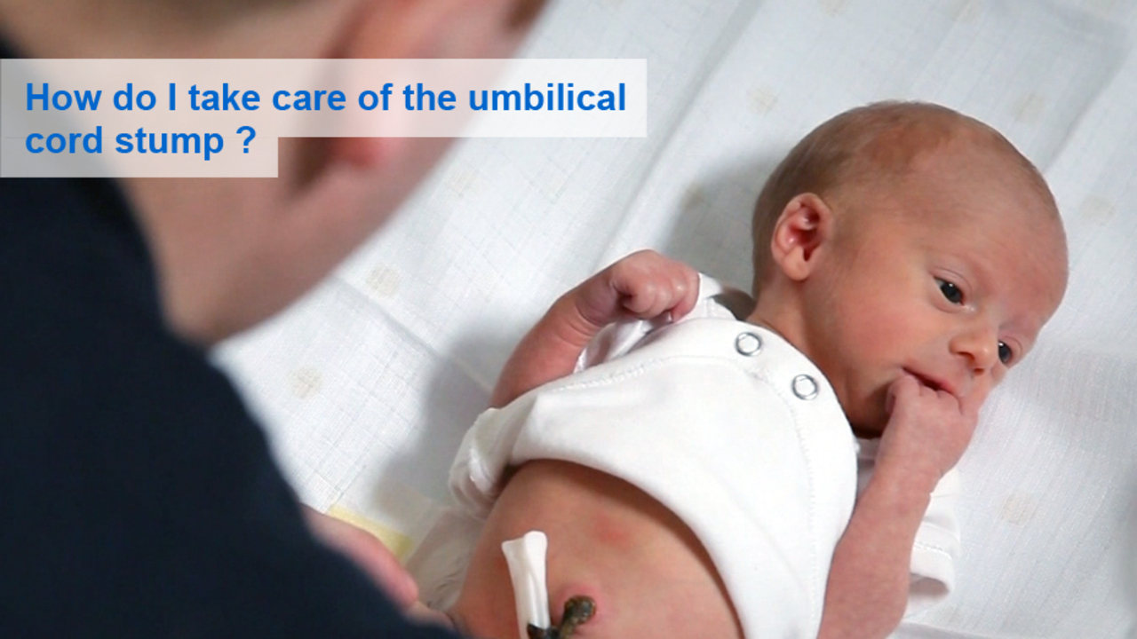 Umbilical Cord Care: No, Don't Pull It Off