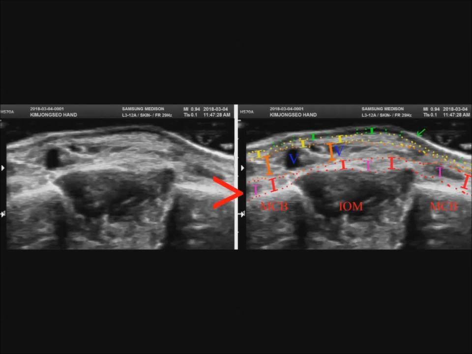 Dorsal aspects of human hand from KVKR-Knuckle Database