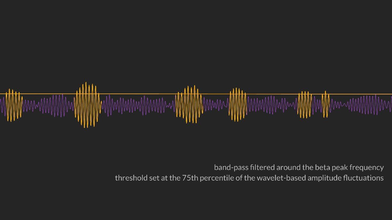 Bursts of beta oscillation differentiate postperformance activity