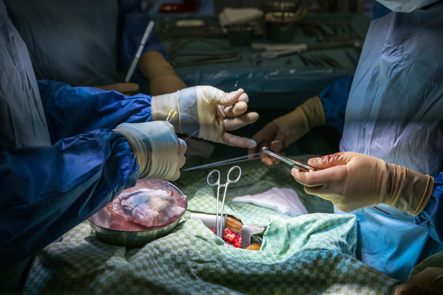 Eine Frage um Leben oder Tod: Wem gehören meine Organe?