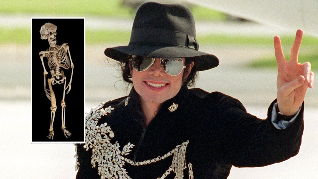 Skurrile Gerüchte um Michael Jackson: Wollte der King of Pop ein deformiertes Skelett kaufen? 