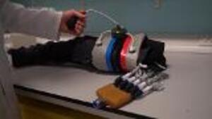 Pioneering New 'Life-Support System' Could Save Limbs Of Injured Soldiers