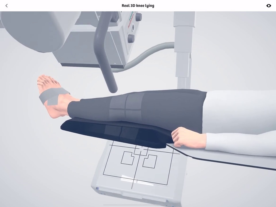 Robotic X-Ray - Clinical Workflows - Siemens Healthineers USA